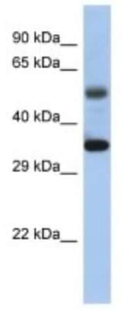 MTERF Rabbit anti-Human, Polyclonal, Novus Biologicals:Antibodies:Primary